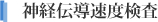 神経伝導速度検査
